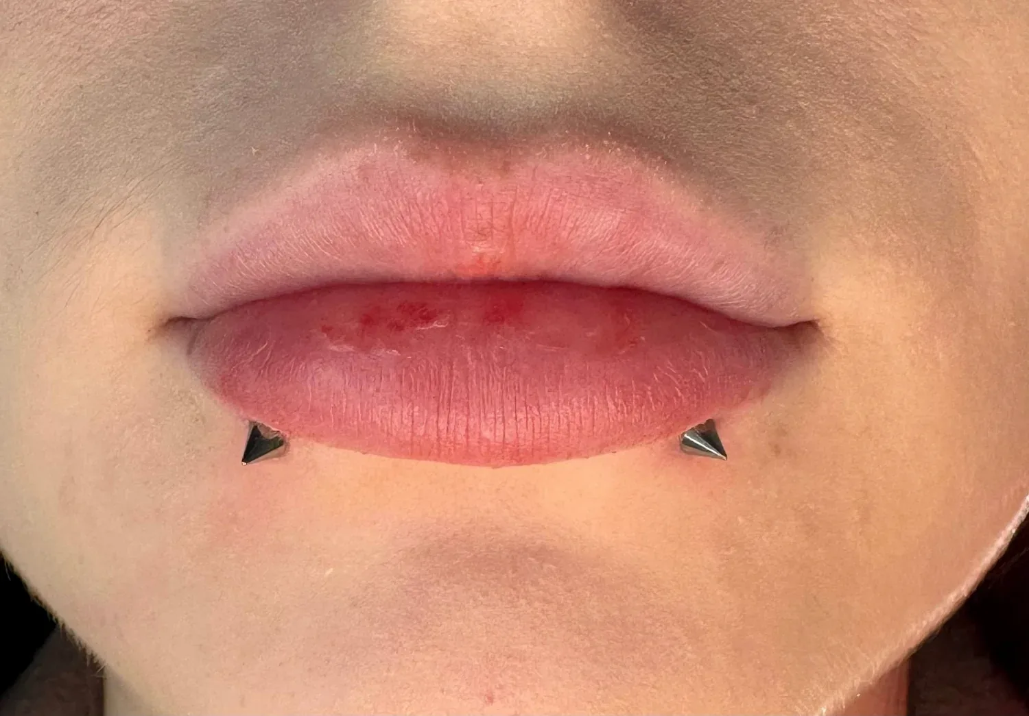 Zaawansowane przekłucie ust - przykład piercingu w Zajawa Tattoo Żary